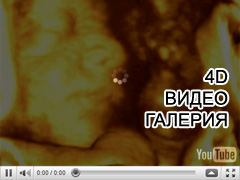 4D видео